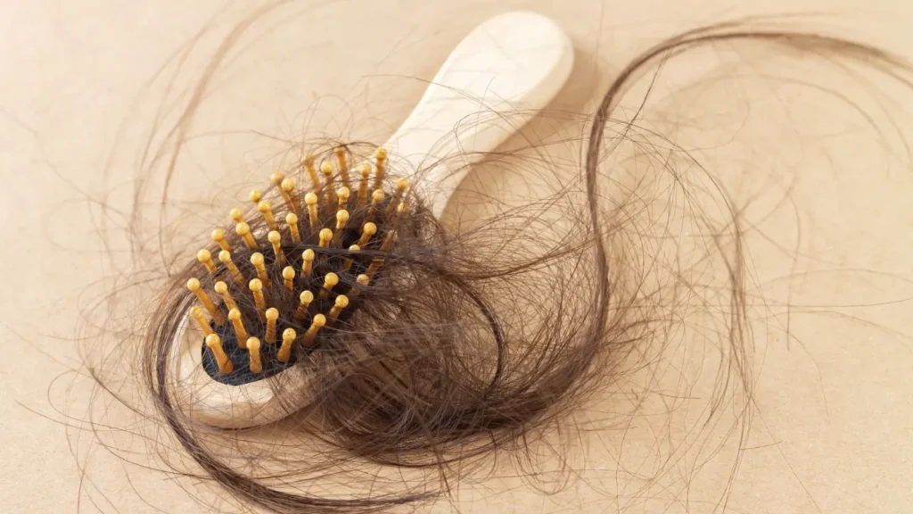 Perte de cheveux et dérèglement hormonal
